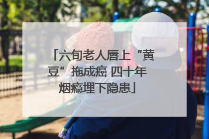 六旬老人唇上“黄豆”拖成癌 四十年烟瘾埋下隐患