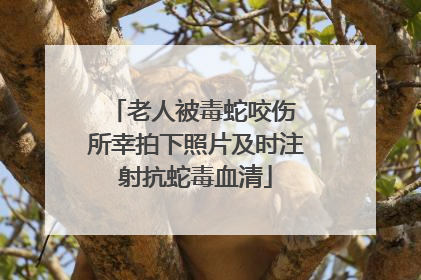 老人被毒蛇咬伤 所幸拍下照片及时注射抗蛇毒血清